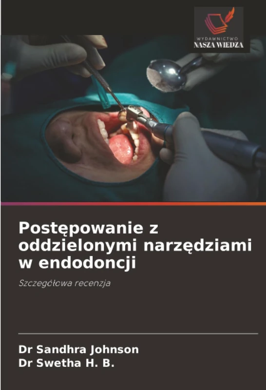 Postępowanie z oddzielonymi narzędziami w endodoncji: Szczegółowa recenzja