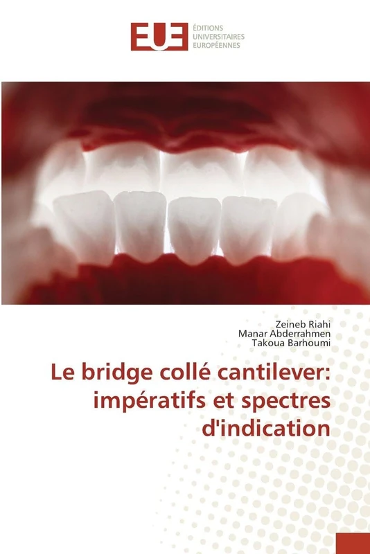 Le bridge collé cantilever: impératifs et spectres d'indication