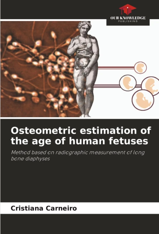 Osteometric estimation of the age of human fetuses: Method based on radiographic measurement of long bone diaphyses - Image 1