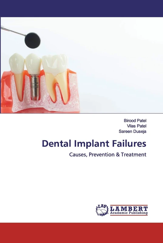 Dental Implant Failures: Causes, Prevention & Treatment