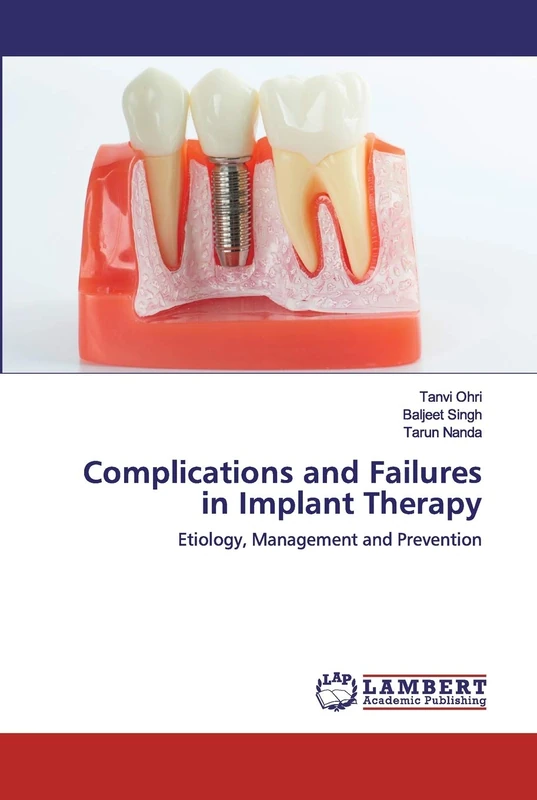 Complications and Failures in Implant Therapy: Etiology, Management and Prevention