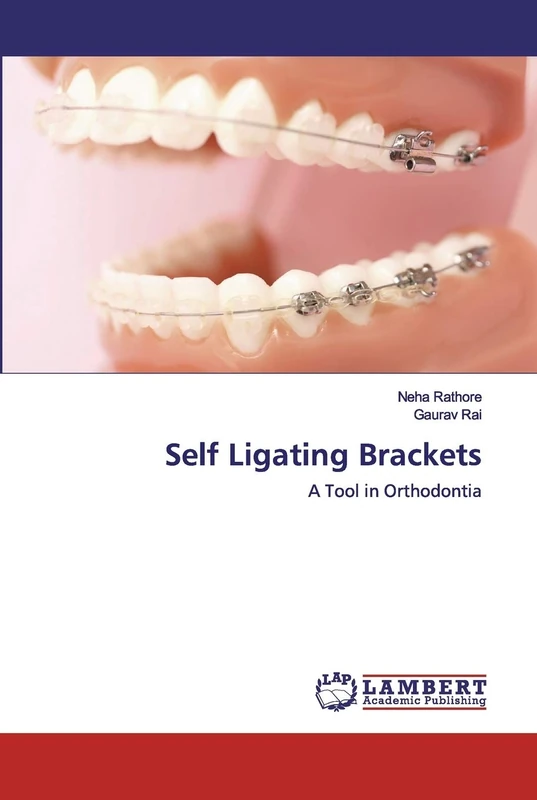 Self Ligating Brackets: A Tool in Orthodontia