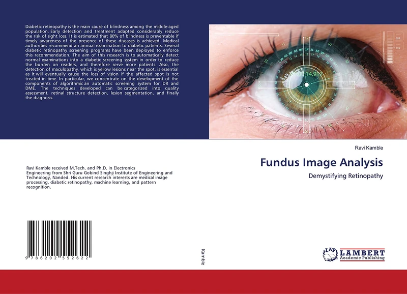 Fundus Image Analysis: Demystifying Retinopathy
