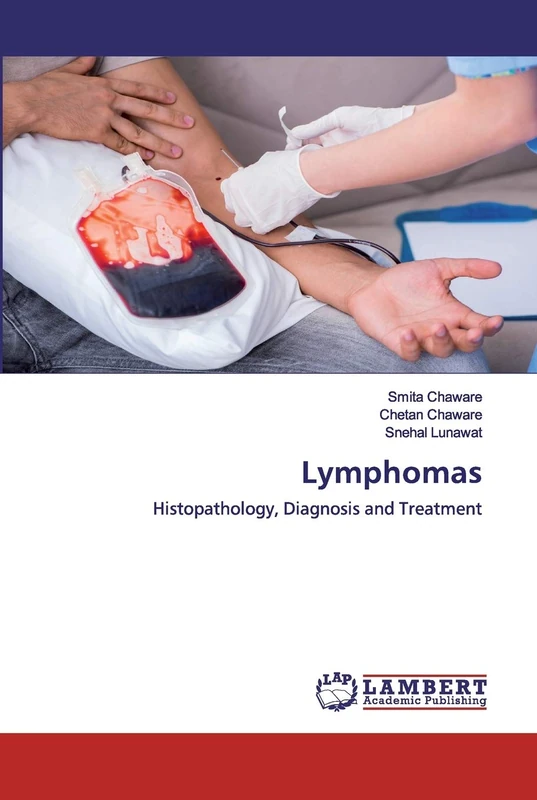 Lymphomas: Histopathology, Diagnosis and Treatment