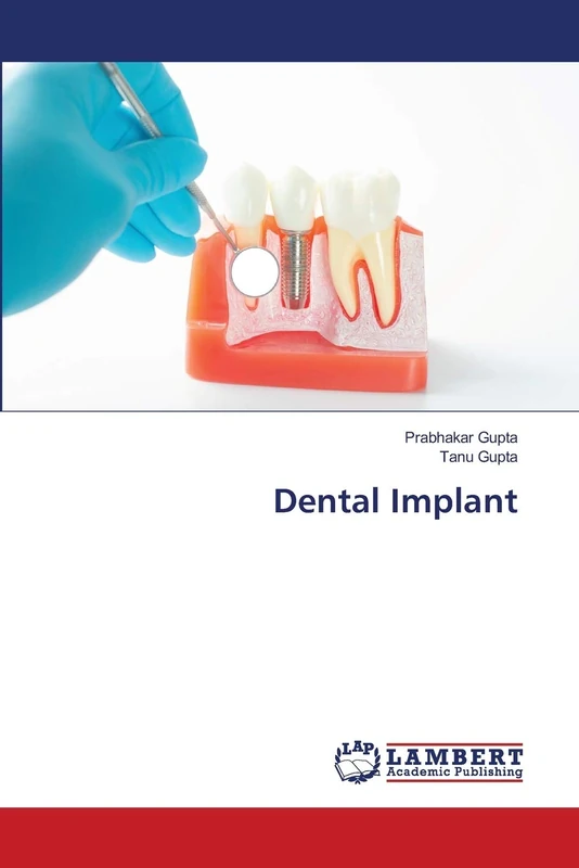 Dental Implant