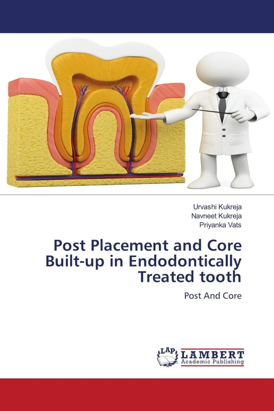 Post Placement and Core Built-up in Endodontically Treated tooth: Post And Core