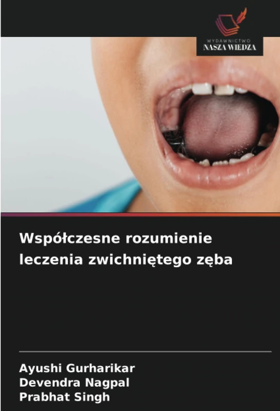 Współczesne rozumienie leczenia zwichniętego zęba