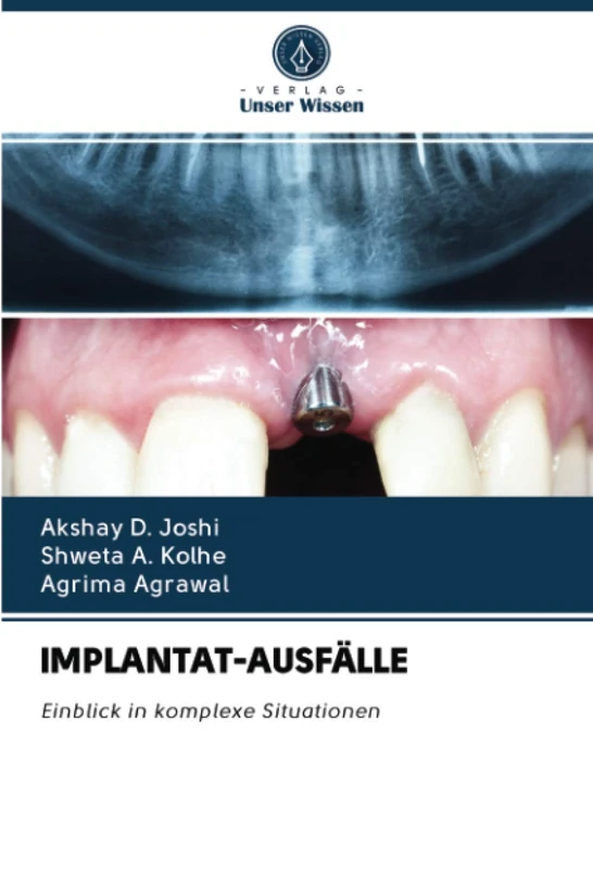 IMPLANTAT-AUSFÄLLE: Einblick in komplexe Situationen - Image 1
