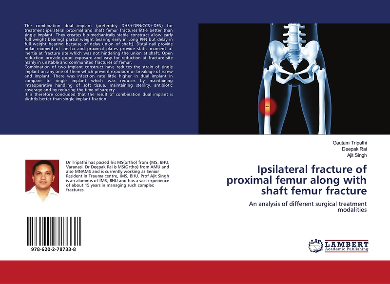 Ipsilateral fracture of proximal femur along with shaft femur fracture: An analysis of different surgical treatment modalities