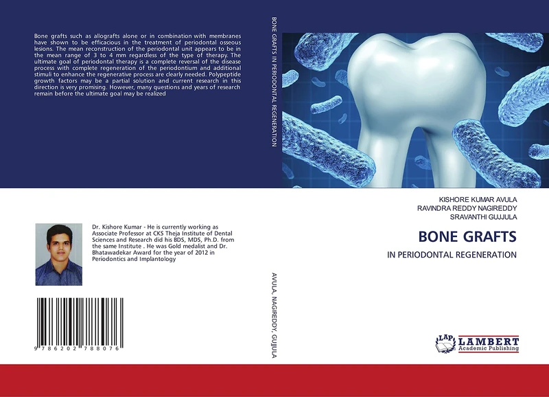 BONE GRAFTS: IN PERIODONTAL REGENERATION