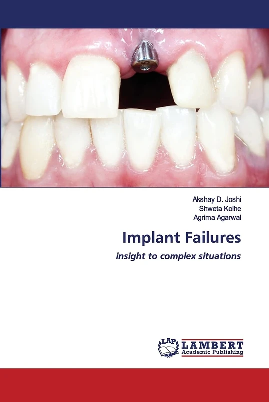 Implant Failures: insight to complex situations
