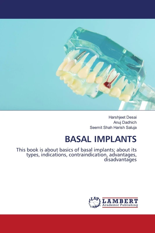BASAL IMPLANTS: This book is about basics of basal implants; about its types, indications, contraindication, advantages, disadvantages