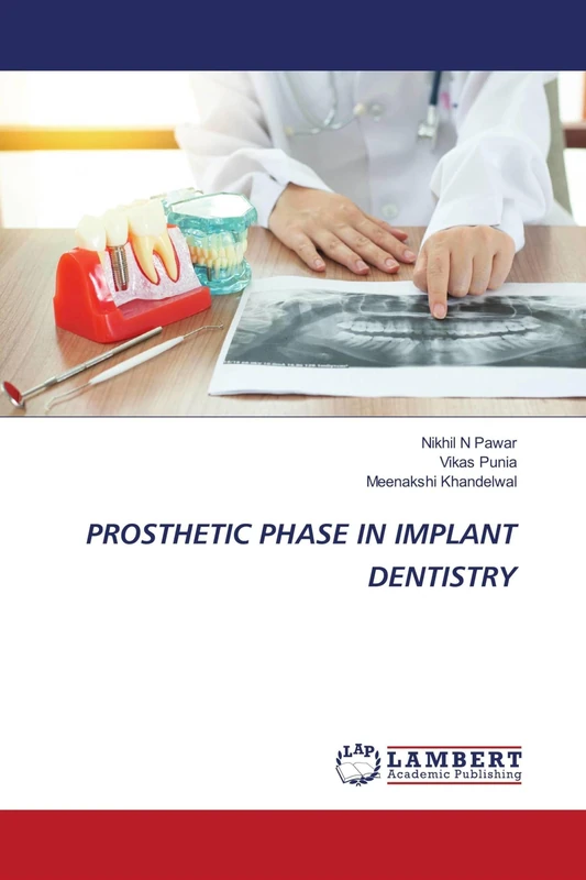 PROSTHETIC PHASE IN IMPLANT DENTISTRY - Image 1