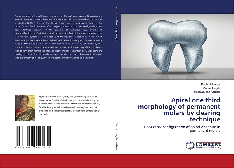 Apical one third morphology of permanent molars by clearing technique: Root canal configuration of apical one third in permanent molars - Image 1
