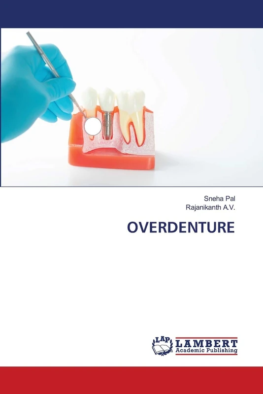 OVERDENTURE
