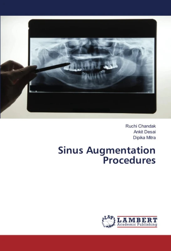 Sinus Augmentation Procedures