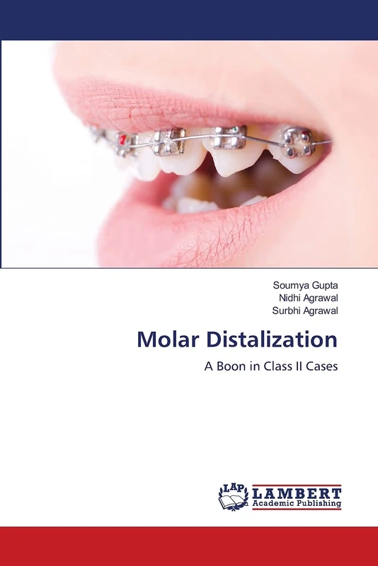 Molar Distalization: A Boon in Class II Cases