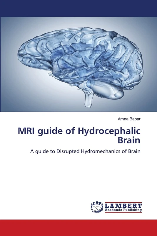 MRI guide of Hydrocephalic Brain: A guide to Disrupted Hydromechanics of Brain