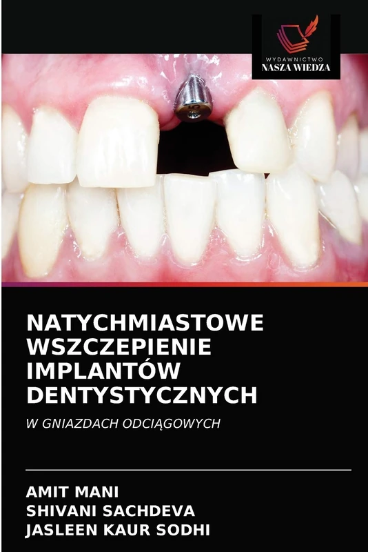 Natychmiastowe Wszczepienie Implantów Dentystycznych: W GNIAZDACH ODCI¿GOWYCH