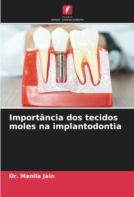 Importância dos tecidos moles na implantodontia