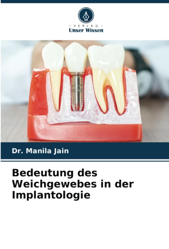 Bedeutung des Weichgewebes in der Implantologie