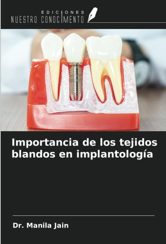 Importancia de los tejidos blandos en implantología