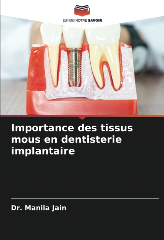 Importance des tissus mous en dentisterie implantaire