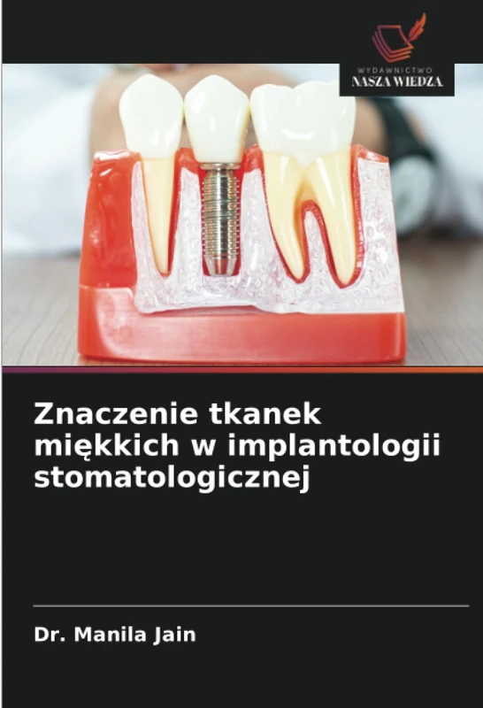 Znaczenie tkanek miękkich w implantologii stomatologicznej