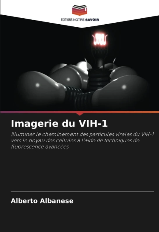Imagerie du VIH-1: Illuminer le cheminement des particules virales du VIH-1 vers le noyau des cellules à l'aide de techniques de fluorescence avancées - Image 1
