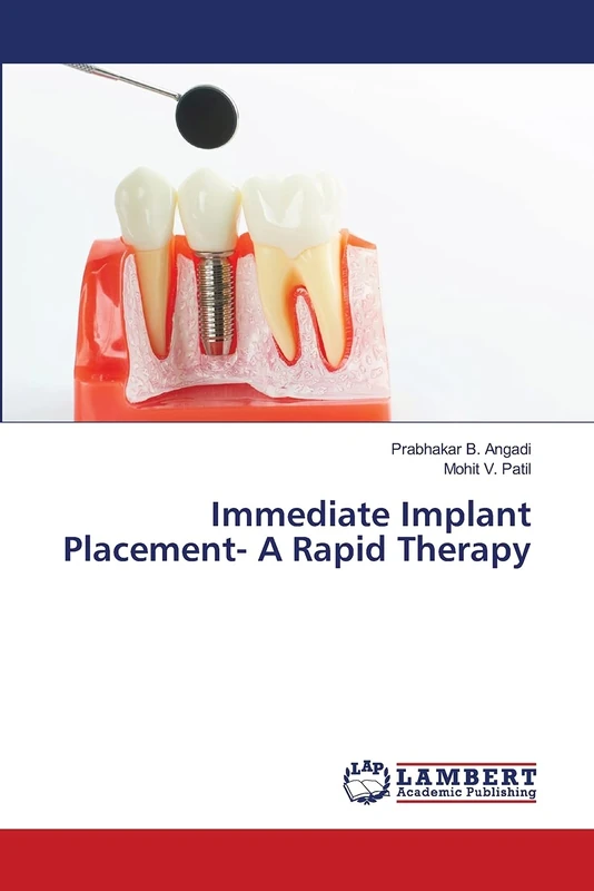Immediate Implant Placement- A Rapid Therapy