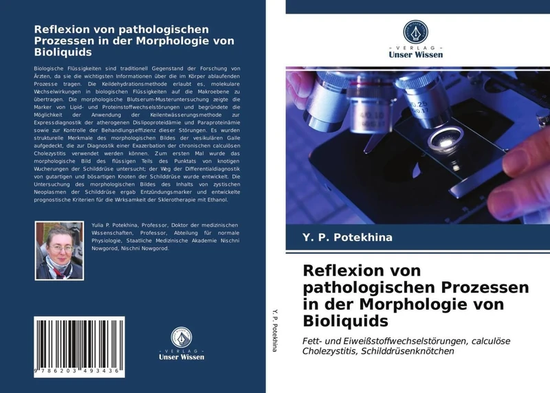 Reflexion von pathologischen Prozessen in der Morphologie von Bioliquids: Fett- und Eiweißstoffwechselstörungen, calculöse Cholezystitis, Schilddrüsenknötchen