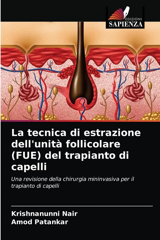 La tecnica di estrazione dell'unità follicolare (FUE) del trapianto di capelli: Una revisione della chirurgia mininvasiva per il trapianto di capelli - Image 1