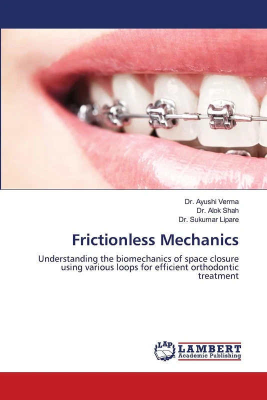 Frictionless Mechanics: Understanding the biomechanics of space closure using various loops for efficient orthodontic treatment