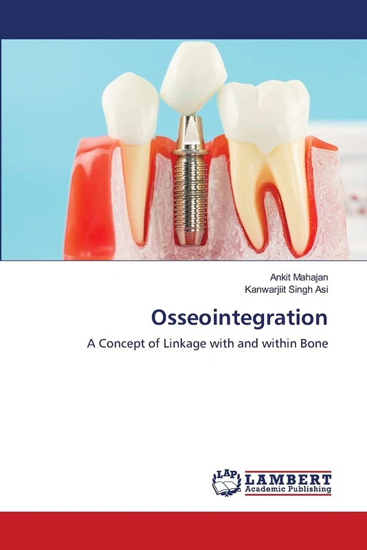 Osseointegration: A Concept of Linkage with and within Bone