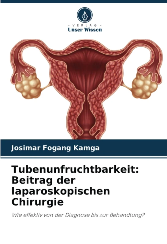 Tubenunfruchtbarkeit: Beitrag der laparoskopischen Chirurgie: Wie effektiv von der Diagnose bis zur Behandlung?