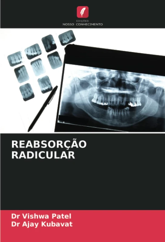 REABSORÇÃO RADICULAR