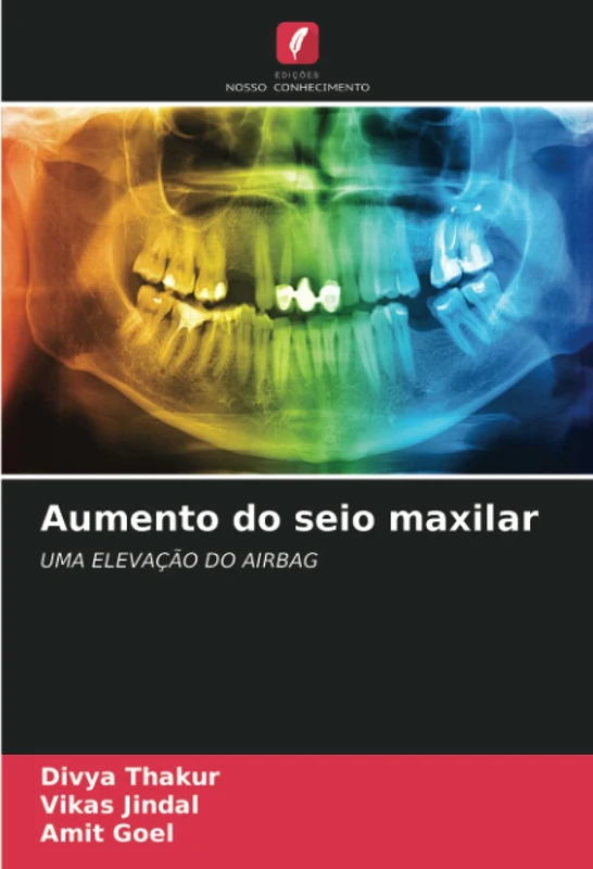 Aumento do seio maxilar: UMA ELEVAÇÃO DO AIRBAG - Image 1