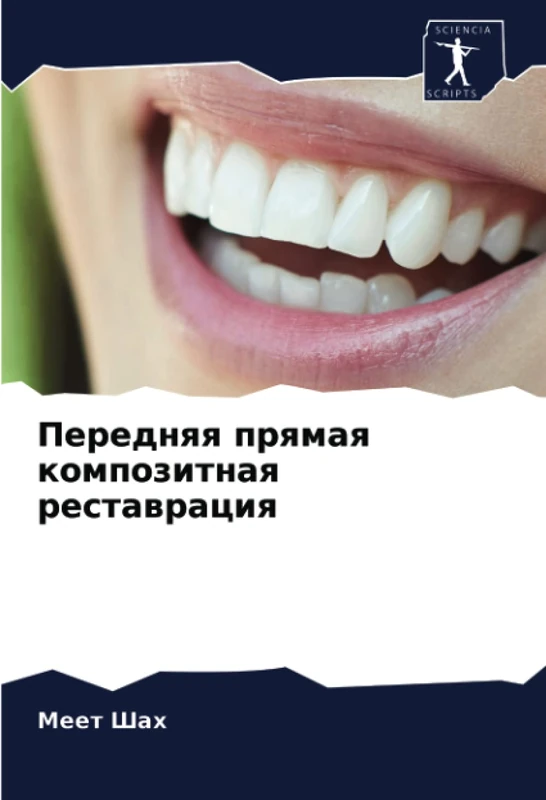 Передняя прямая композитная реставрация