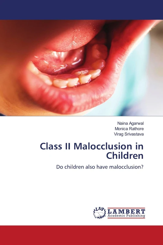 Class II Malocclusion in Children: Do children also have malocclusion?