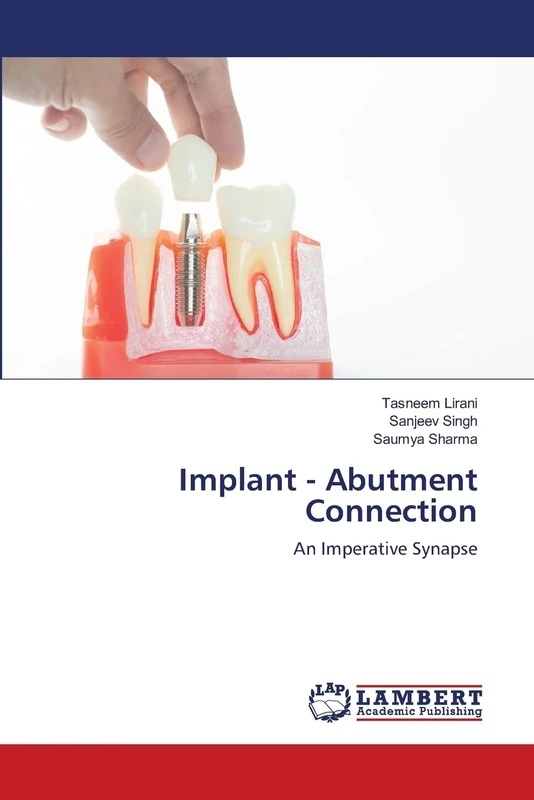 Implant - Abutment Connection: An Imperative Synapse - Image 1