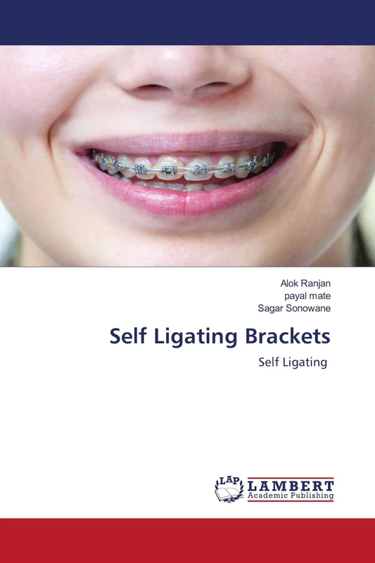 Self Ligating Brackets: Self Ligating