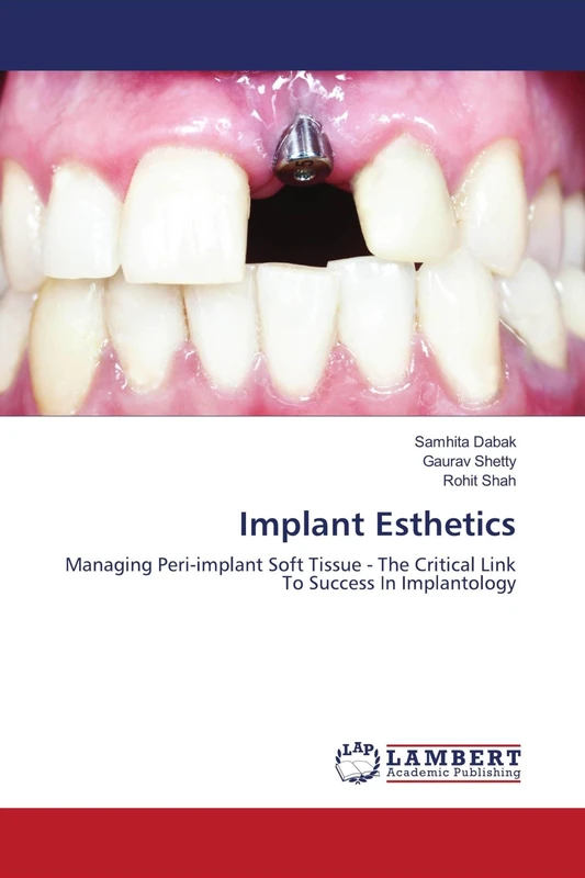 Implant Esthetics: Managing Peri-implant Soft Tissue - The Critical Link To Success In Implantology - Image 1
