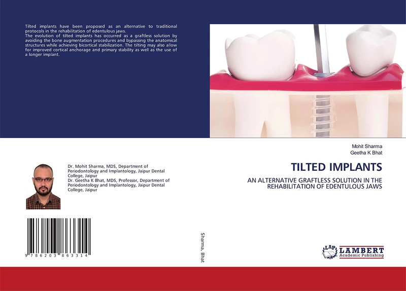 Tilted Implants: An Alternative Graftless Solution in the Rehabilitation of Edentulous Jaws