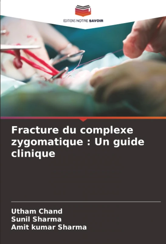 Fracture du complexe zygomatique : Un guide clinique
