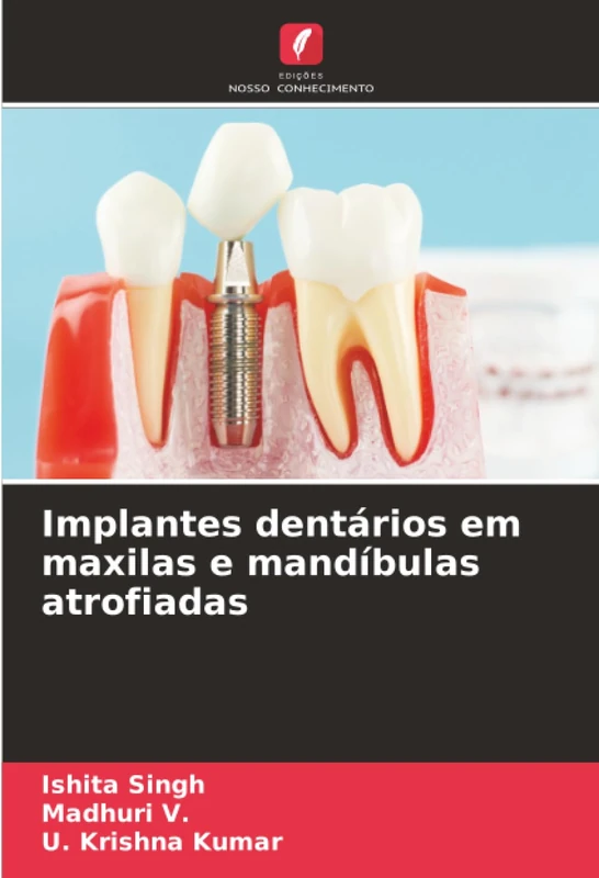 Implantes dentários em maxilas e mandíbulas atrofiadas