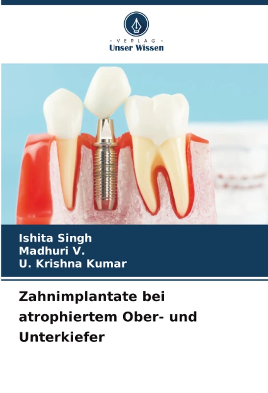 Zahnimplantate bei atrophiertem Ober- und Unterkiefer