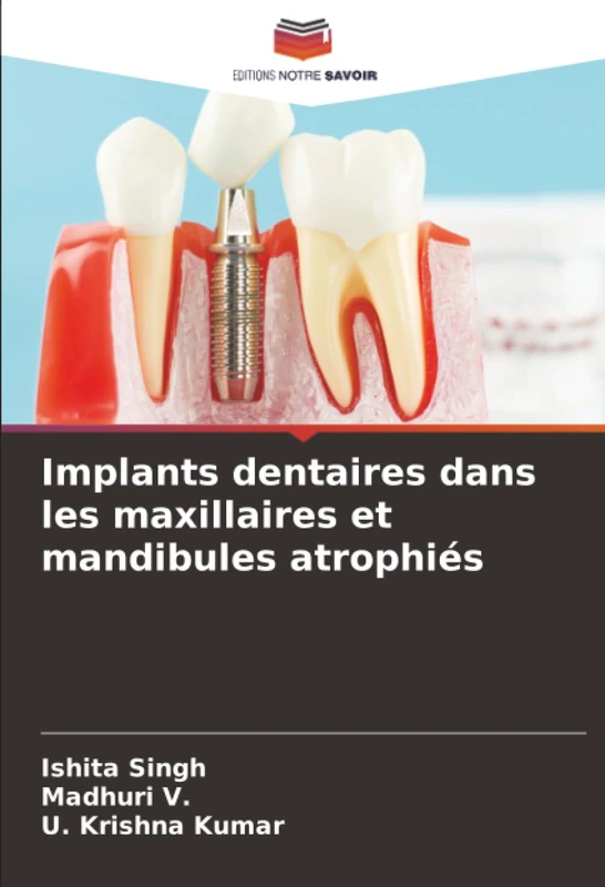 Implants dentaires dans les maxillaires et mandibules atrophiés