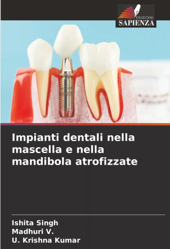 Impianti dentali nella mascella e nella mandibola atrofizzate