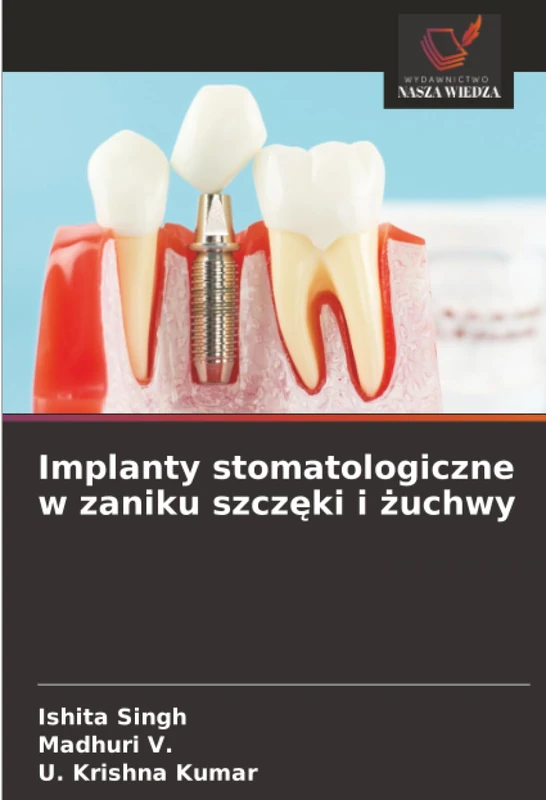 Implanty stomatologiczne w zaniku szczęki i żuchwy