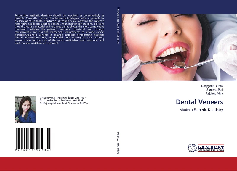 Dental Veneers: Modern Esthetic Dentistry